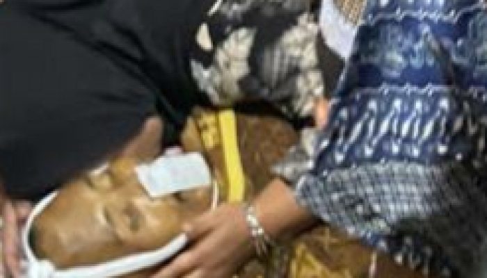 17 Hari Dirawat di RS, Korban Penembakan Oleh Oknum Penjaga Kebun Marihat Meninggal Dunia