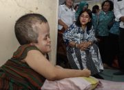 Ny Liswati Wesly Silalahi Kunjungi Sukma Adhany, Beri Bantuan dan Semangat