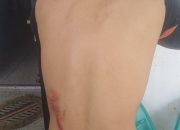 “MABUK”, Oknum Dokter Forensik RSUD Djasamen Saragih dan Oknum Pejabat Pajak Tanjung Pinang Aniaya ASN Satpol PP