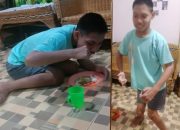 16 Tahun Disabilitas, Rapi Anak Kembar di Asahan Hidup Tanpa Bantuan: “Kalau Bisa Dapat Dana untuk Perawatan”