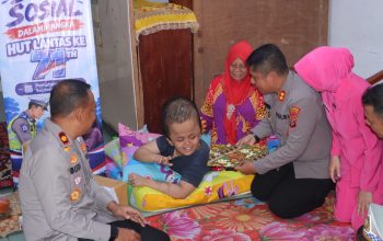 Sambut Hari Lantas Bhayangkara ke-71, Kapolres Pematangsiantar Sambangi Anak Hidrosefalus