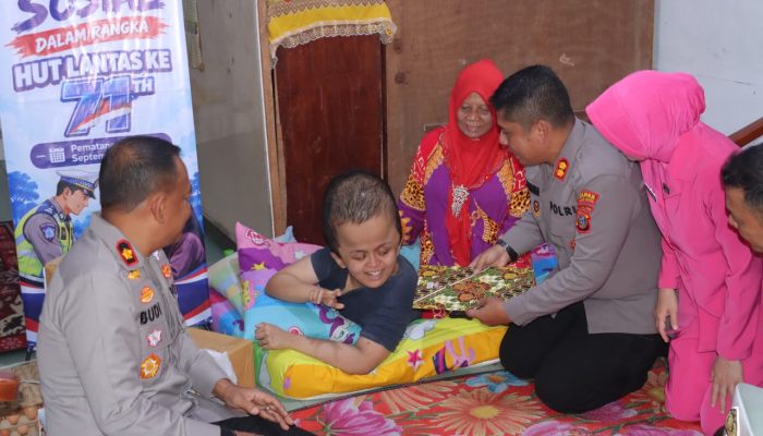 Sambut Hari Lantas Bhayangkara ke-71, Kapolres Pematangsiantar Sambangi Anak Hidrosefalus