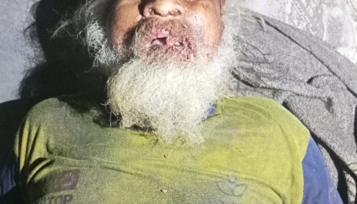 Polsek Purba Tangani Penemuan Lansia ODGJ Meninggal di Simpang Hinalang, Polisi Imbau Keluarga Segera Melapor